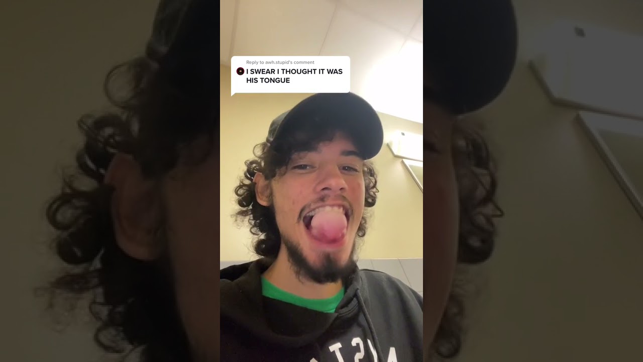 Man Is Able to Puff Up Tongue by Controlling Tongue Muscles - 1273072