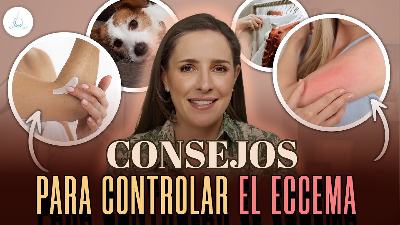 🔴 10 CONSEJOS que NO SABIAS sobre el ECCEMA @drapilarochoa - Dermatologa
