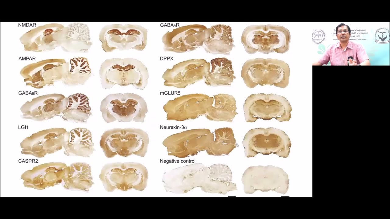 Autoimmune encephalitis : Dr. Vivek Mathew
