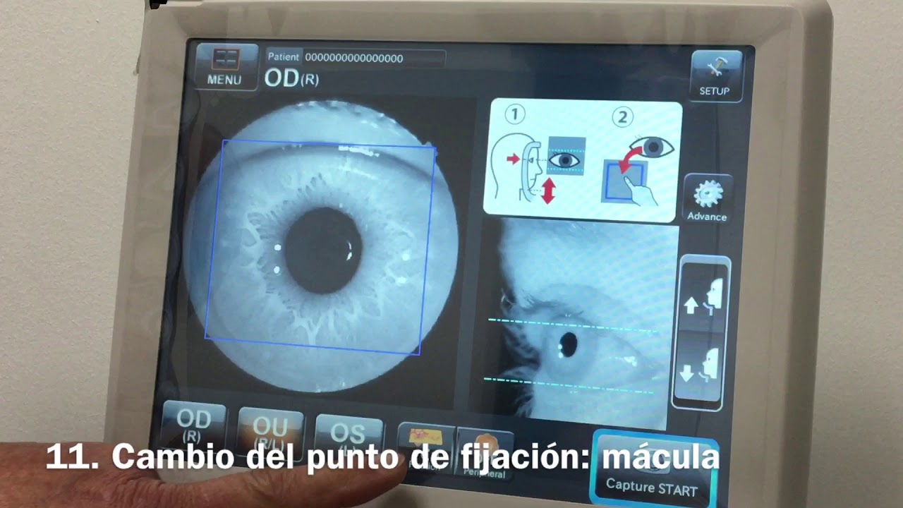 Uso retinógrafo TOPCON