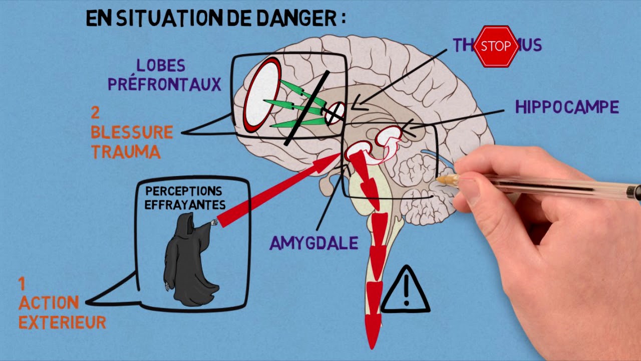 2- Les traumas et leurs conséquences sur le cerveau