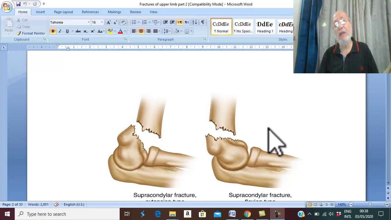 Orthopedic in Arabic 15 ( Supracondylar fracture , part 1 ), by Dr. Wahdan