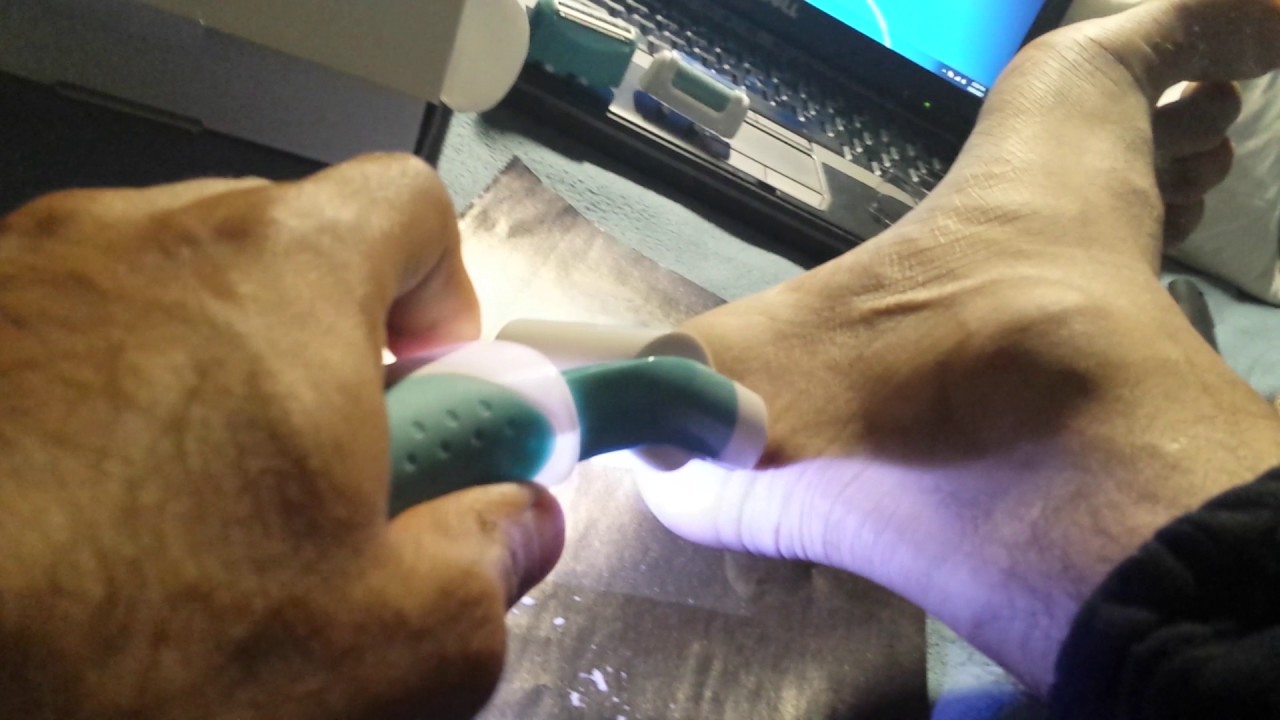 callus remover review