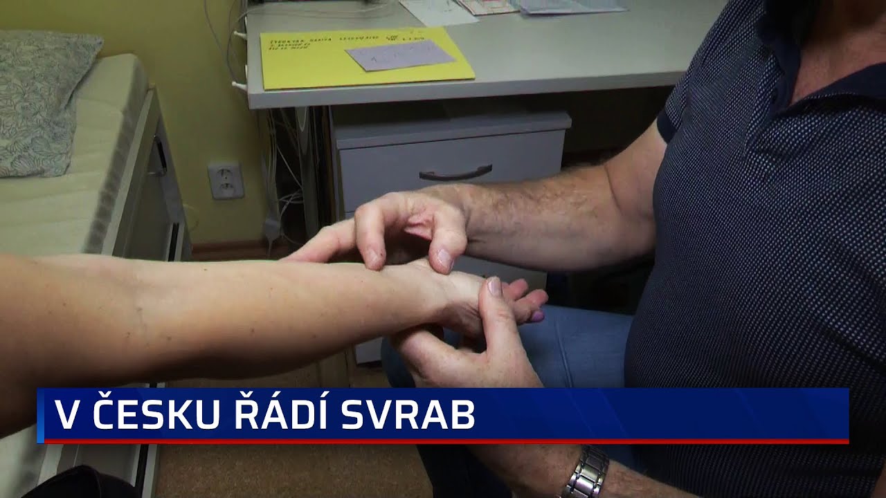 V Česku ř&aacute;d&iacute; svrab, na vině je i migrace. Jak&eacute; jsou př&iacute;znaky a jak parazita dostat z těla?