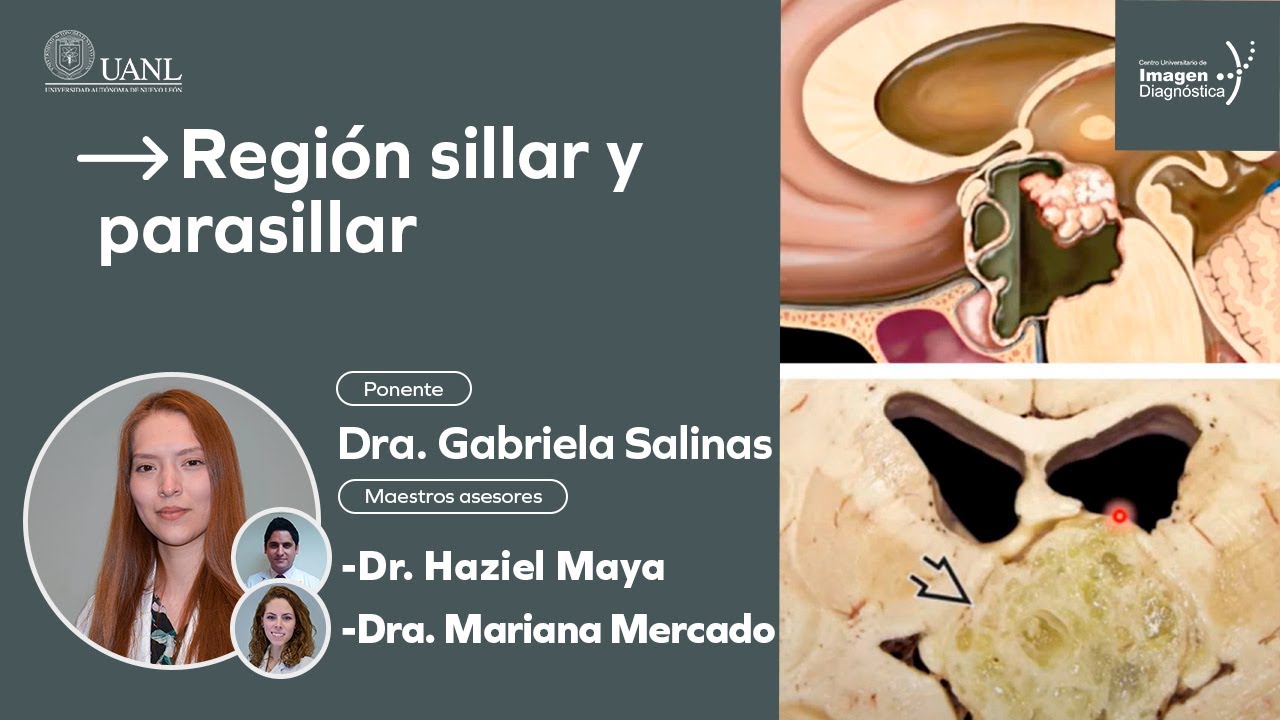 Región sillar y parasillar por la Dra. Gabriela Salinas.