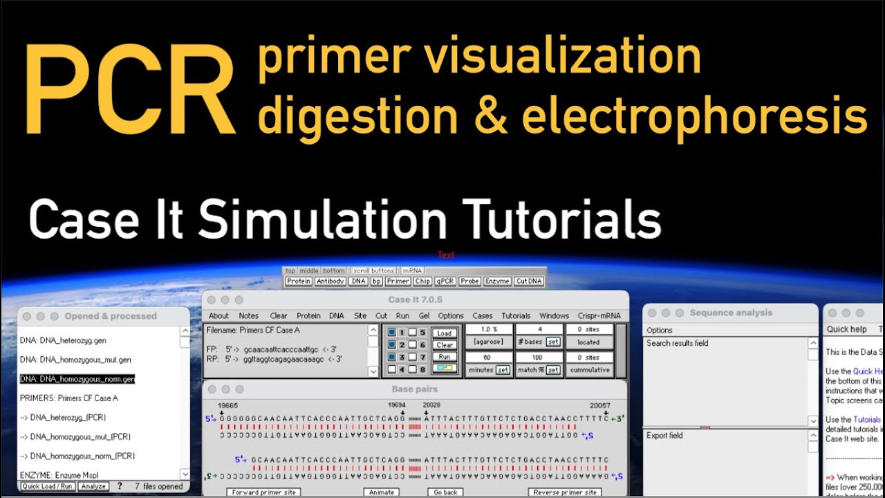 PCR: primers, digestion and electrophoresis using control sequences from the Cystic Fibrosis case