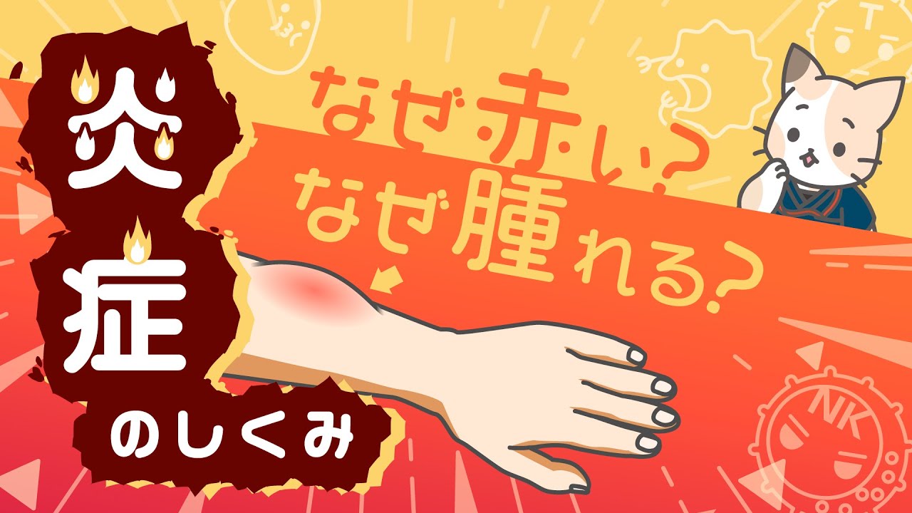 蚊に刺されるとなぜ腫れる？炎症のしくみ　～炎症の4徴候、慢性炎症、抗炎症薬～