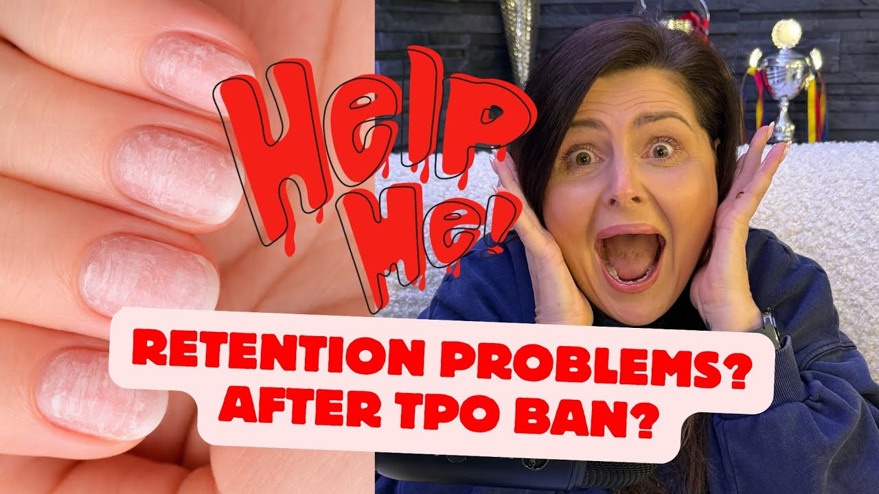 RETENTION PROBLEMS⁉️ AFTER TPO BAN😳