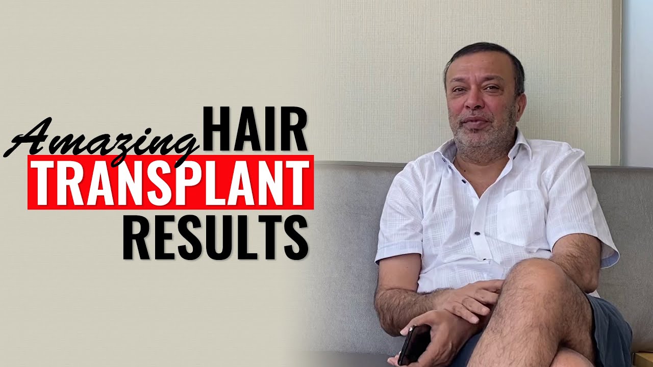 Amazing Hair Transplant Results | Life-Changing Experience | Client Testimonial