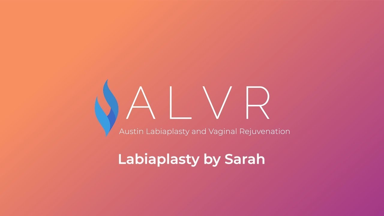 Commonly Asked Questions About Labiaplasty