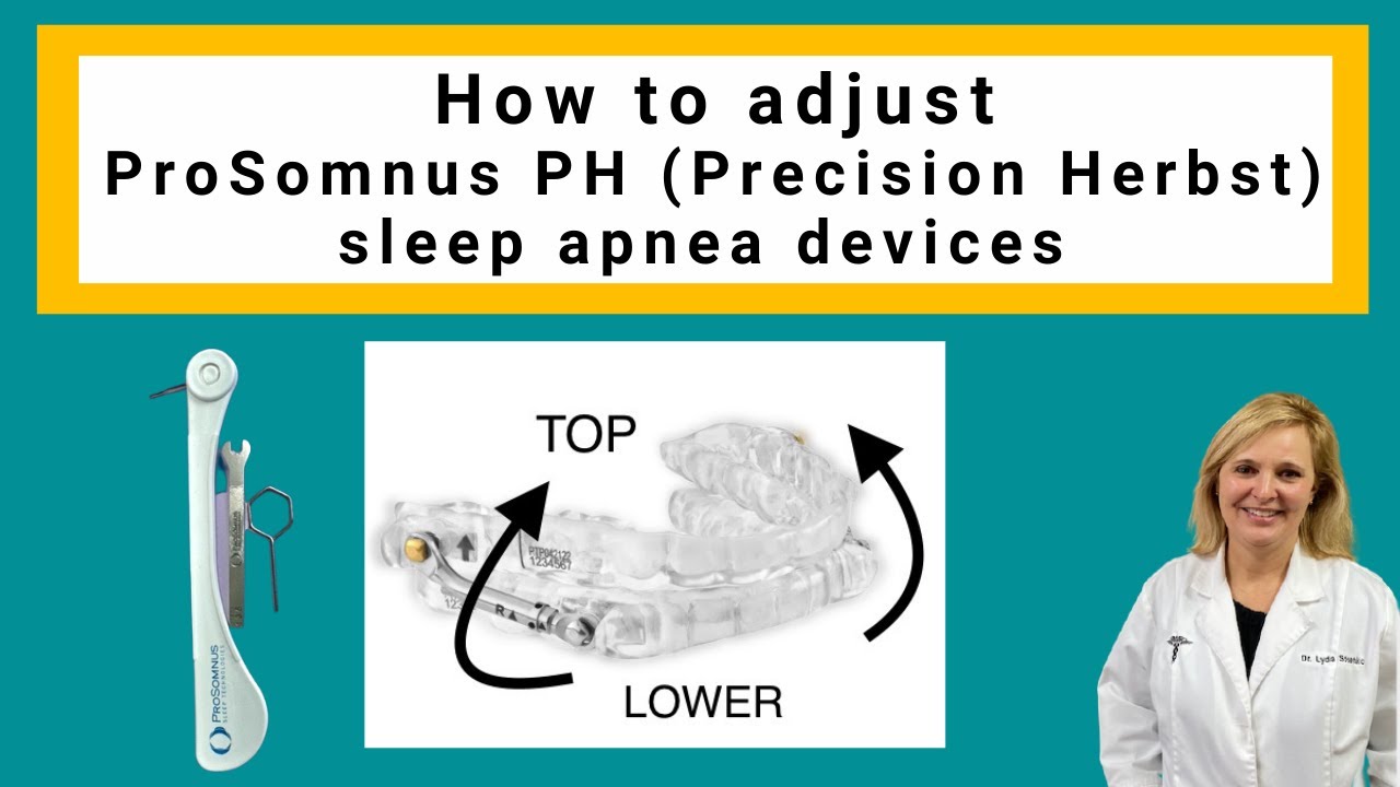 How to Advance the ProSomnus PH Dental Sleep Appliance