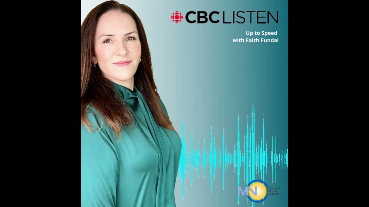 How to Prevent & Detect Melanoma CBC News