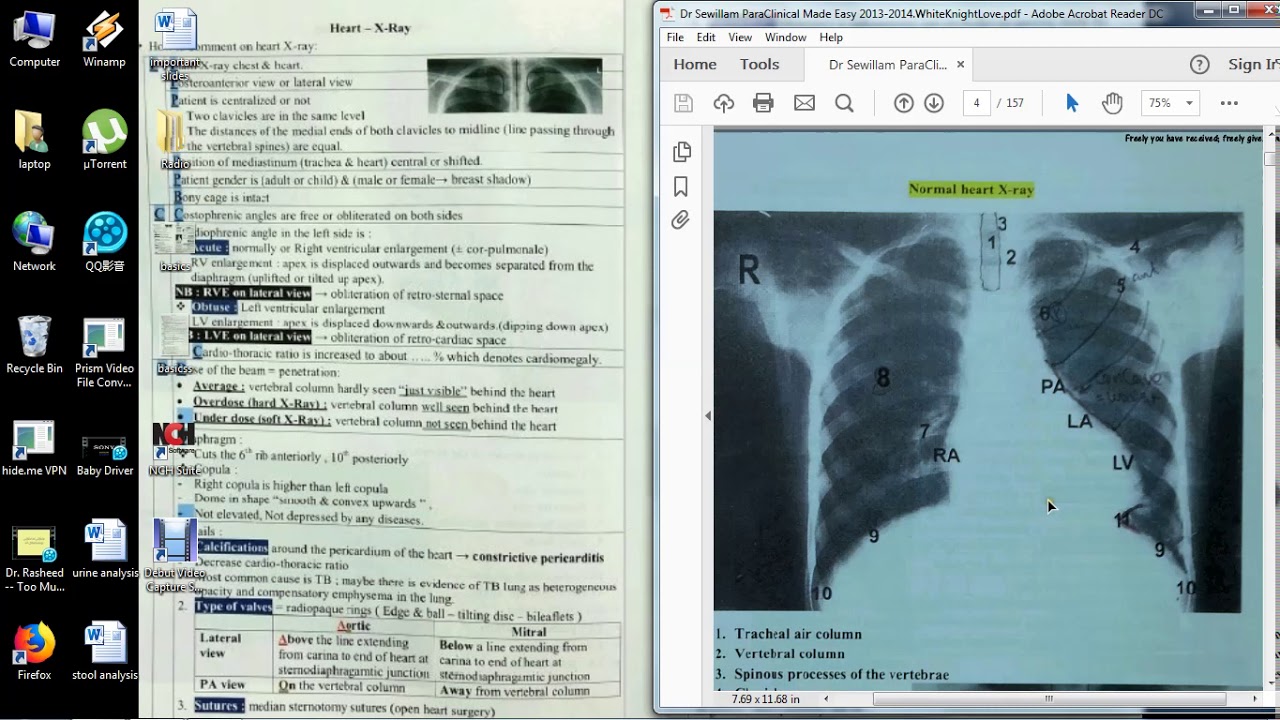 Paraclinical Internal Medicine : Radiology ( Part 1: cardio&chest )