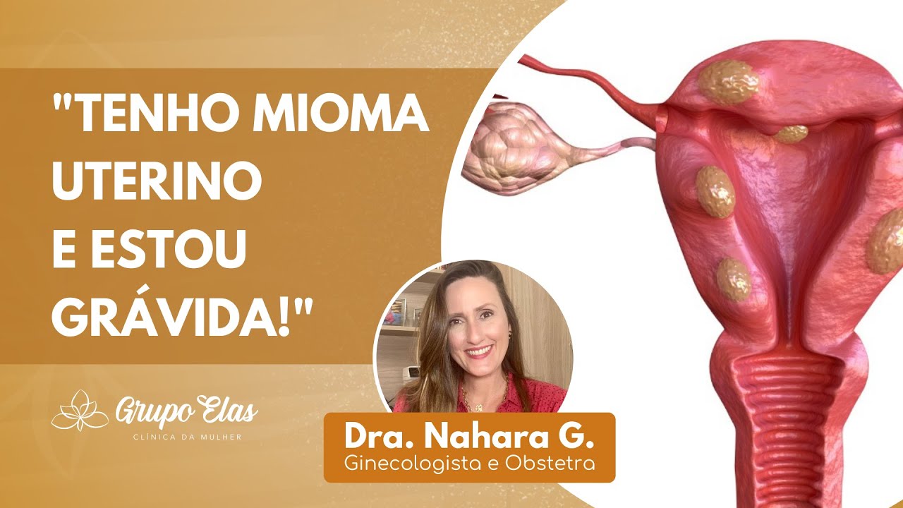 GESTAÇÃO & MIOMA | Atrapalha a Gravidez? O que fazer? | Dra. Nahara Gomes | Obstetra Humanizada