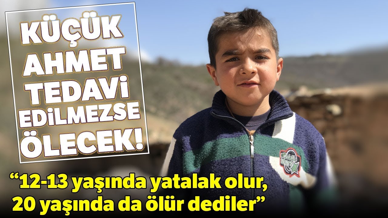 DMD Hastası Küçük Ahmet Tedavi Edilmezse Ölecek