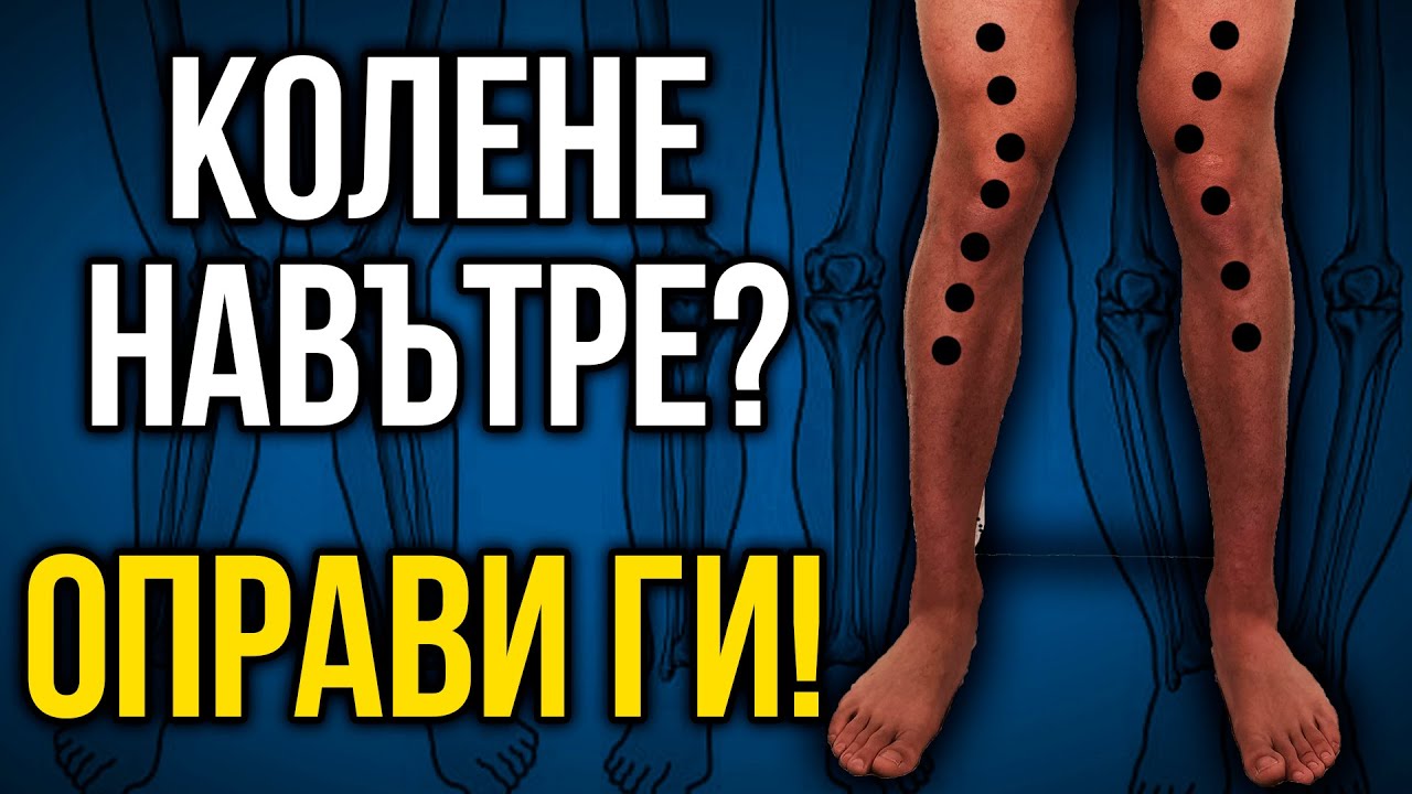 Как да изправим КОЛЕНЕ НАВЪТРЕ (valgus knees) - 3 упражнения + прогресии