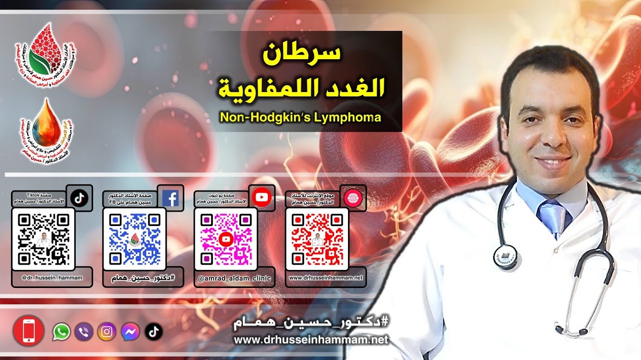 اللمفوما غير هودجكن (سرطان الغدد اللمفاوية) - أستاذ #دكتور_حسين_همام - دكتوراه أمراض وسرطانات الدم