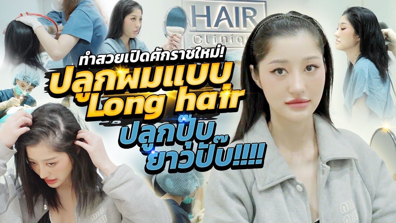 ปลูกผมแบบ Long hair ปลูกปุ๊บ ยาวปั๊บ!! | Milky Praiya Ep.194