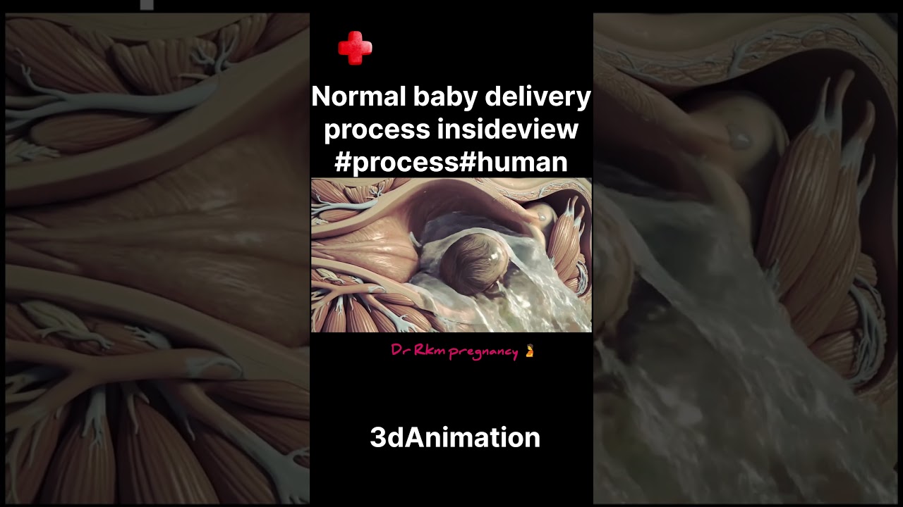 Normal baby delivery process insideview 