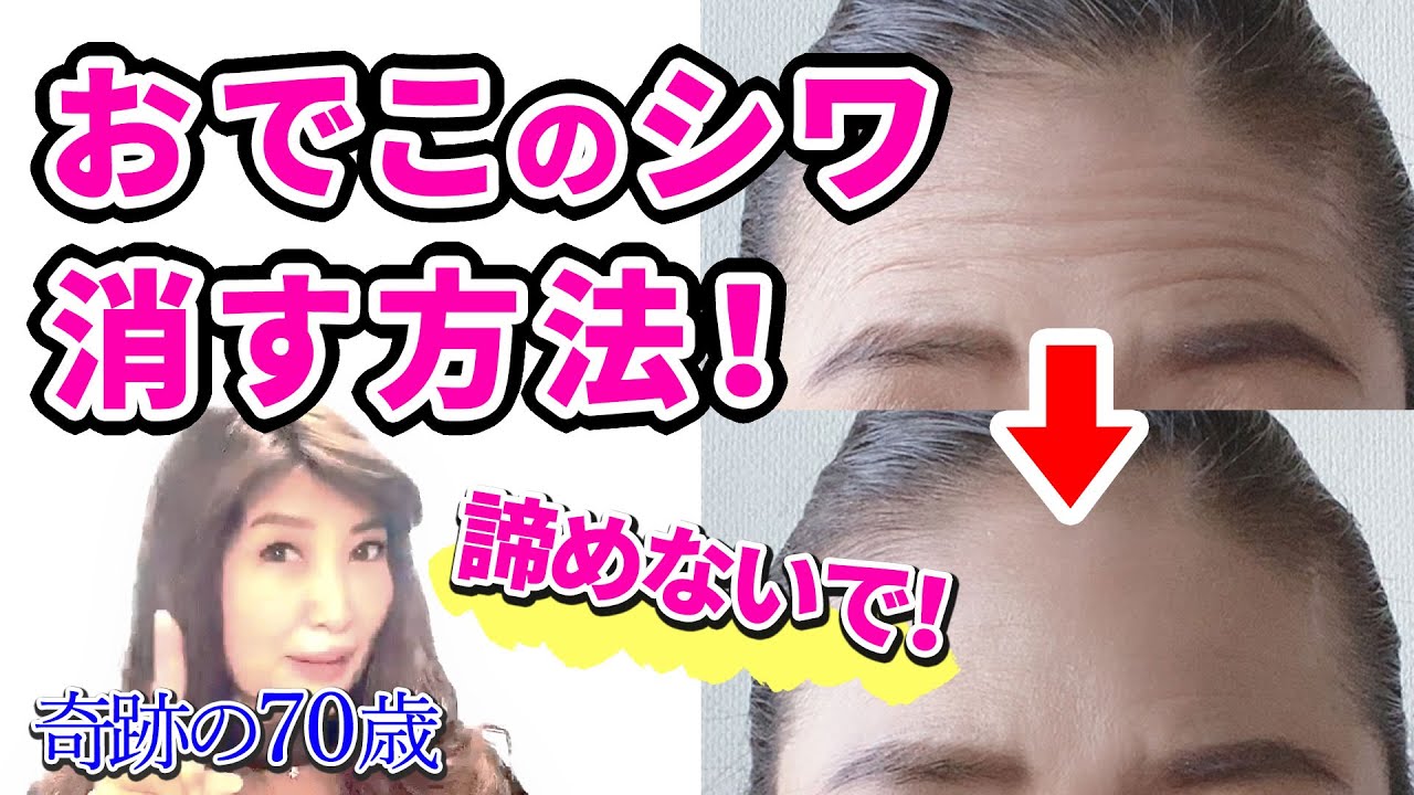 【奇跡の70歳】おでこのシワ諦めないで！おでこのシワ消す方法。