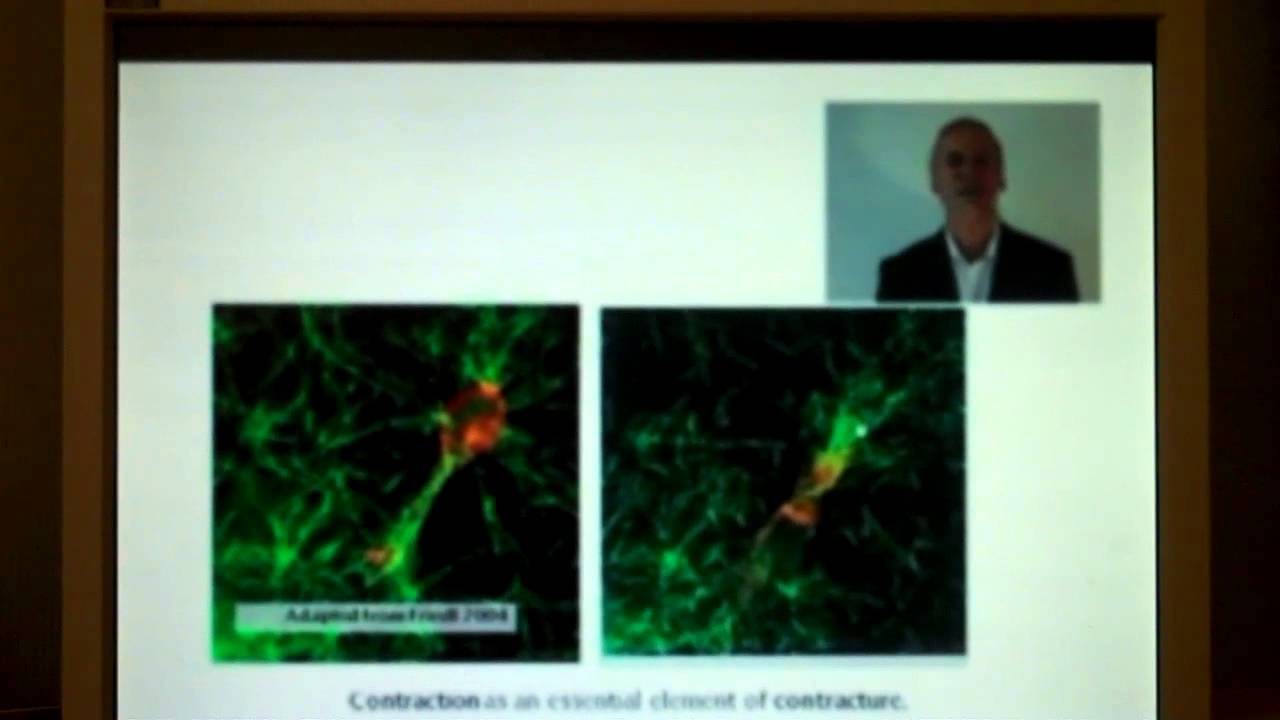 Myofibroblasts