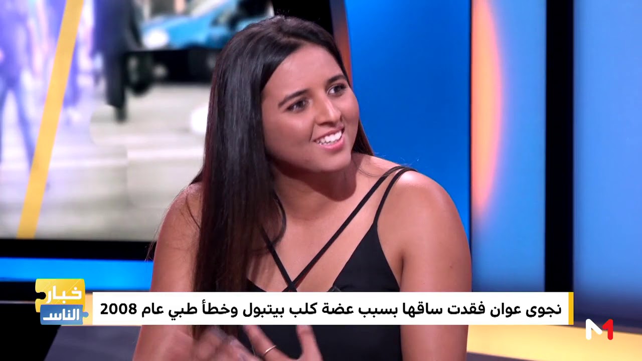 نجوى عوان تحكي قصة فقدانها لساقها بسبب عضة كلب وأخطاء طبية