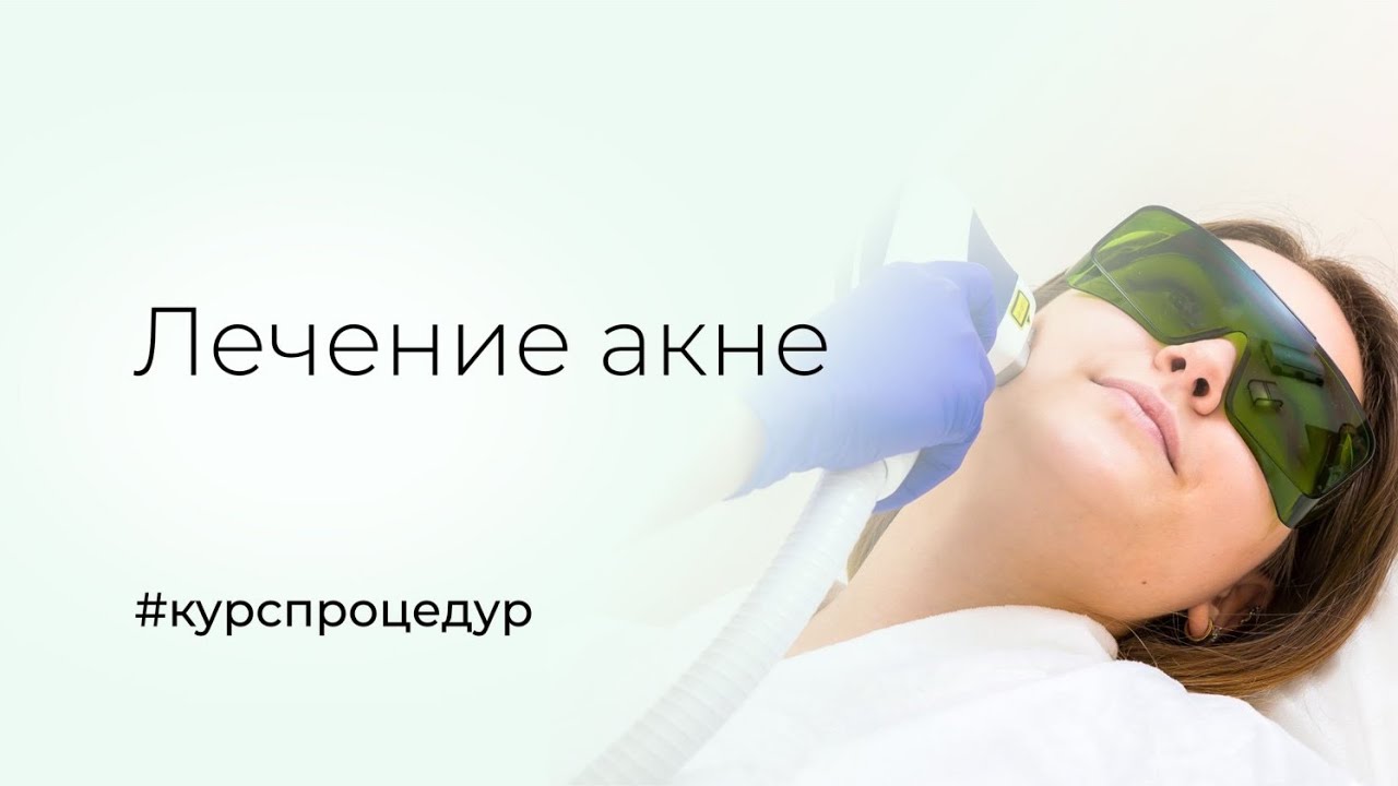 Лечение прыщей на диодном лазере Mediostar Next Pro в Брянске