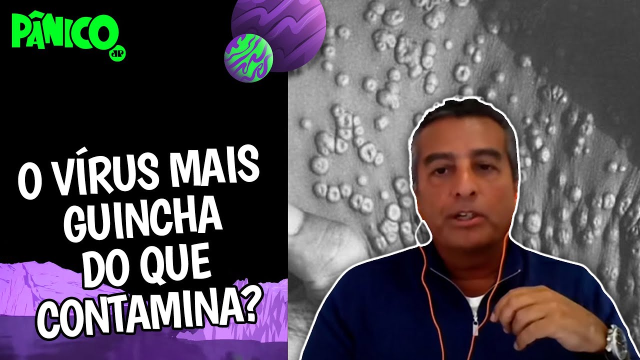 Dr. Zeballos: 'VAR&Iacute;OLA DO MACACO N&Atilde;O &Eacute; FATAL E NEM DEVE GERAR MEDO NAS PESSOAS'