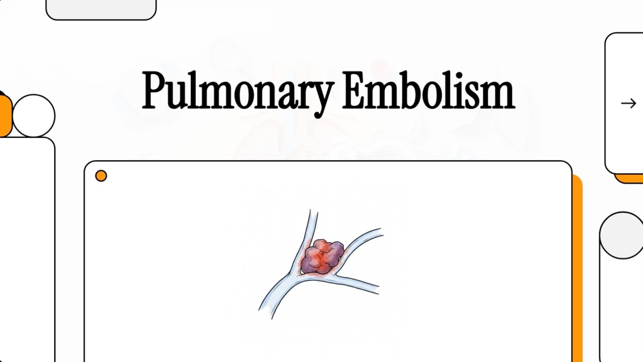 MET - 78 - Pulmonary Embolism - Explainer Video