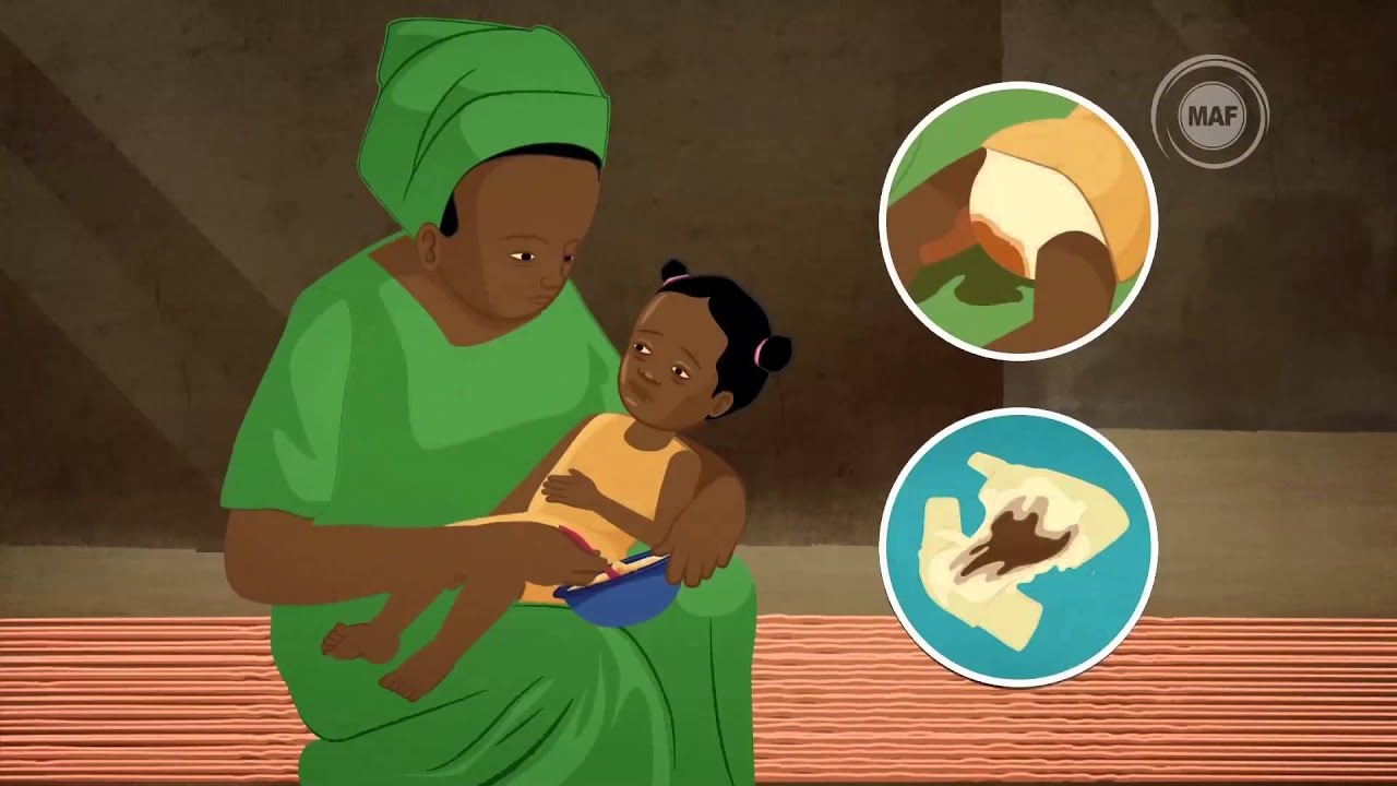 Votre enfant est-il malade? Reconna&icirc;tre la pneumonie, la diarrh&eacute;e et le paludisme (Version Compl&egrave;te)