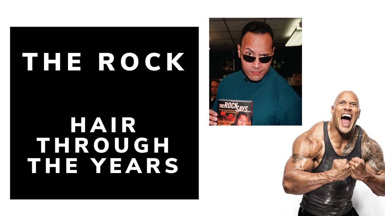 The Rock's Hair Through the Years, Celebrity Hair Transplant Surgeon Analysis