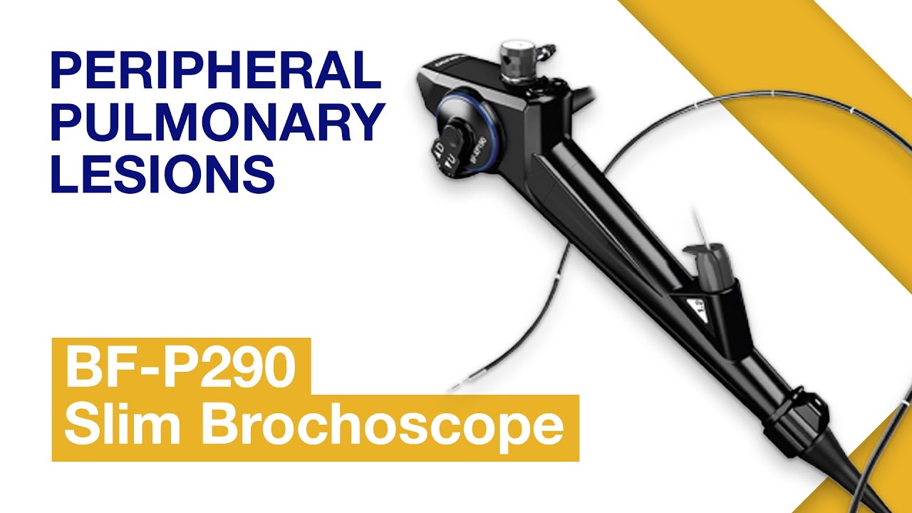 Minimally Invasive Peripheral Diagnostics with Olympus BF-P290 Slim Bronchoscope | Bronchoscopy