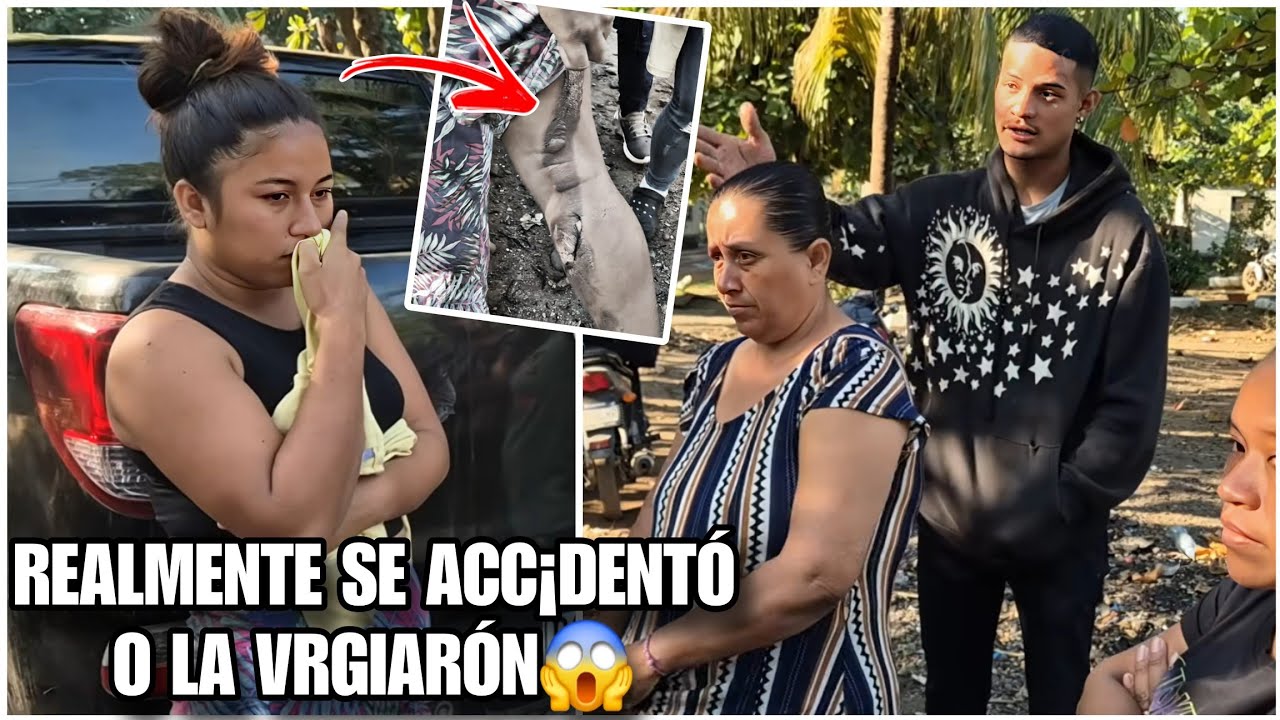 Mire como quedó de mal erida la mujer del primo de pauloba/la flaka la vrgio dijerón todos😱