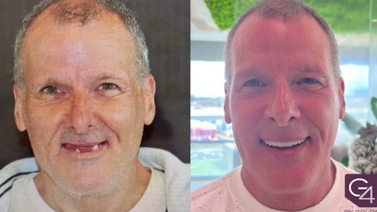 G4 By Golpa Patient Testimonials - Mario's Story
