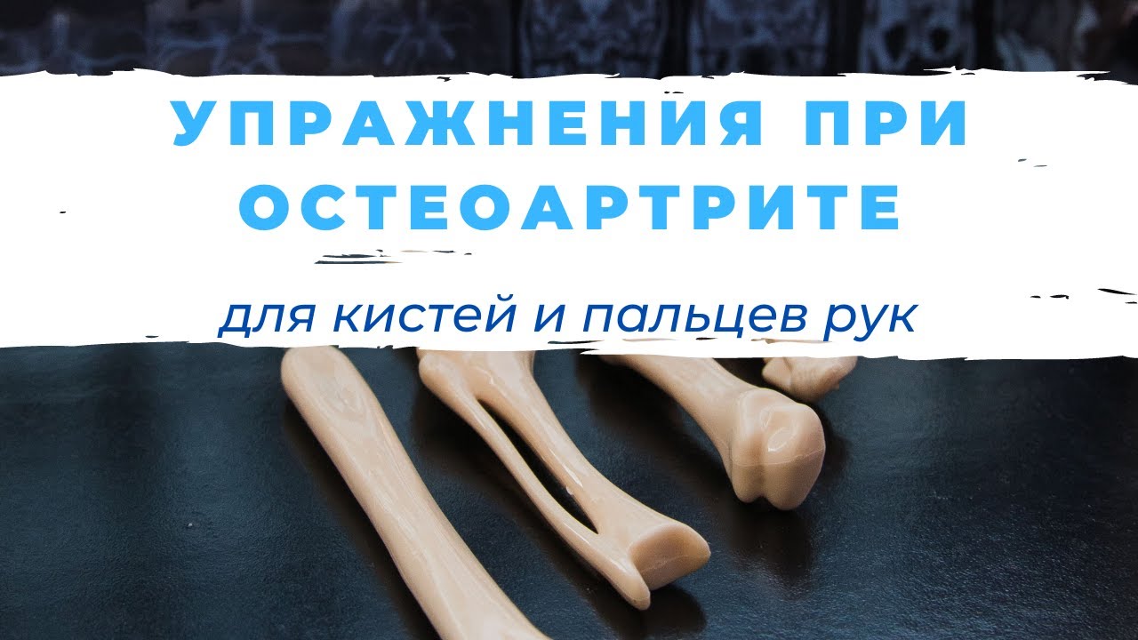 Упражнения при остеоартрите для кистей и пальцев рук