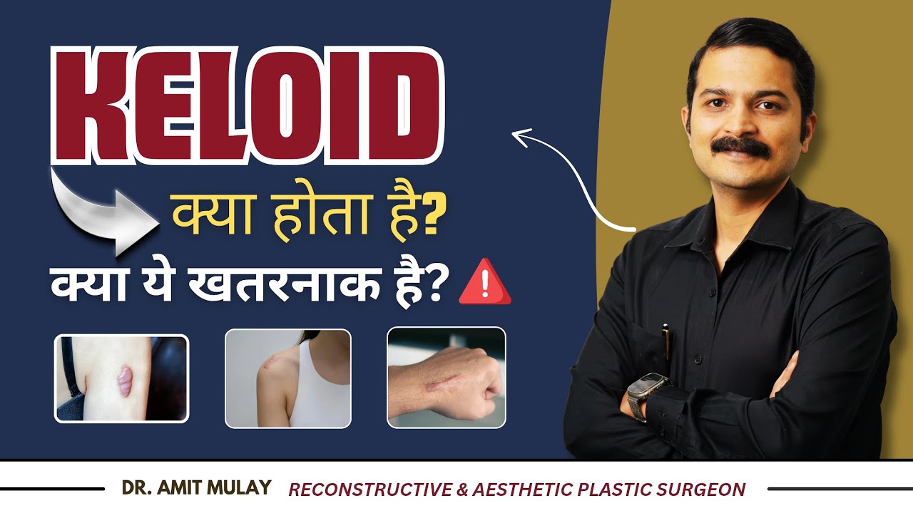 Struggling With Keloid Scars? Here’s What You Should Know | Dr. Amit Mulay | Plastic Surgeon
