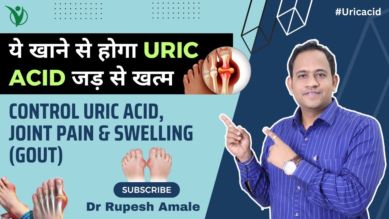 यूरिक एसिड के लक्षण, कारण और घरेलू उपचार | Control Uric Acid, Joint Pain & Swelling (Gout)