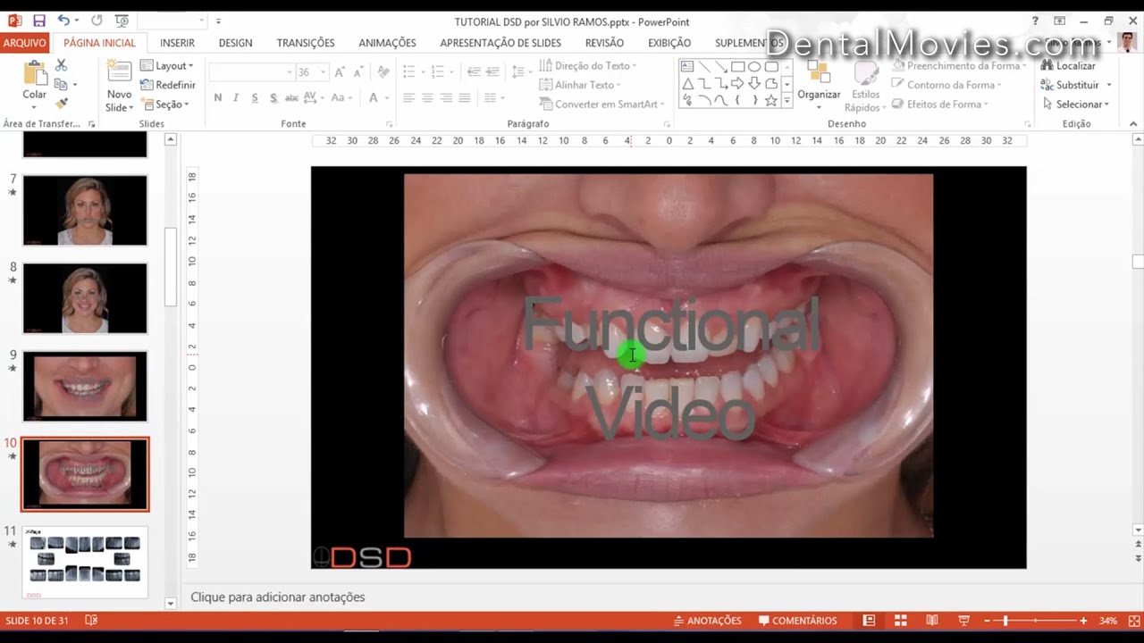 Digital Smile Design - Christian Coachman & Livio Yoshinaga - PART 1/4