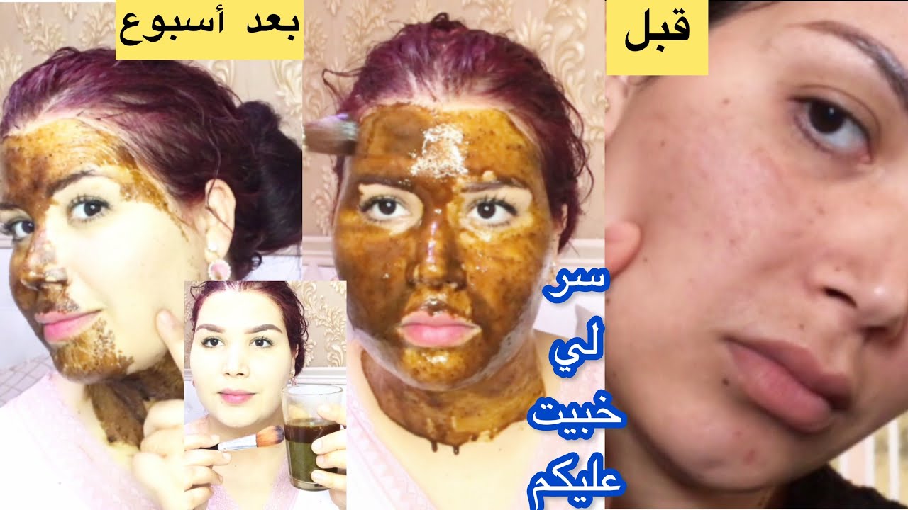 أول مرة سر لخبيت عليكم ودعي لكلف ولو يكون المستعصي التصبغات السواد النمش أسبوع واحد/فقط دعيلي