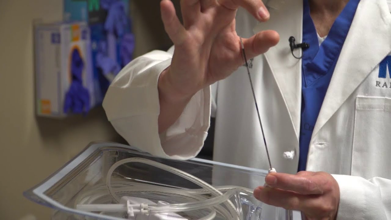 Ablation procedure saves patient's kidney