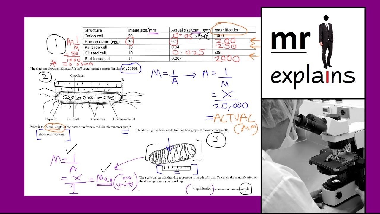 mr i explains: How to calculate Magnification (using example Biology exam questions)
