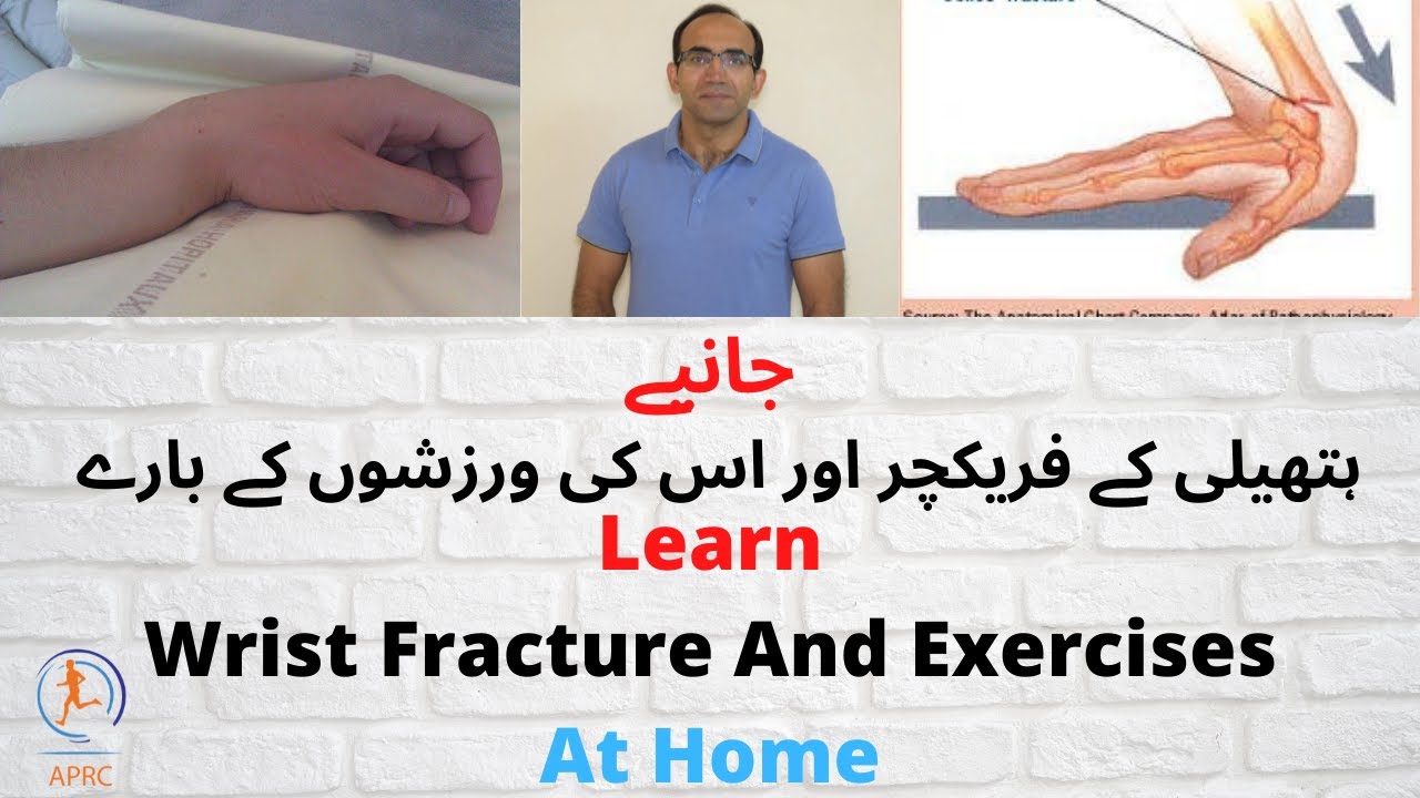 Learn Everything About Wrist Fracture | It's Treatment | Recovery And Exercises At Home | Urdu/Hindi