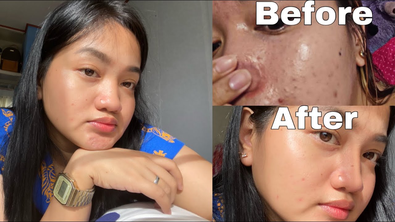 RYX HYDRA GLOW SET One month review (TIPS + How to use) 🧚🏻