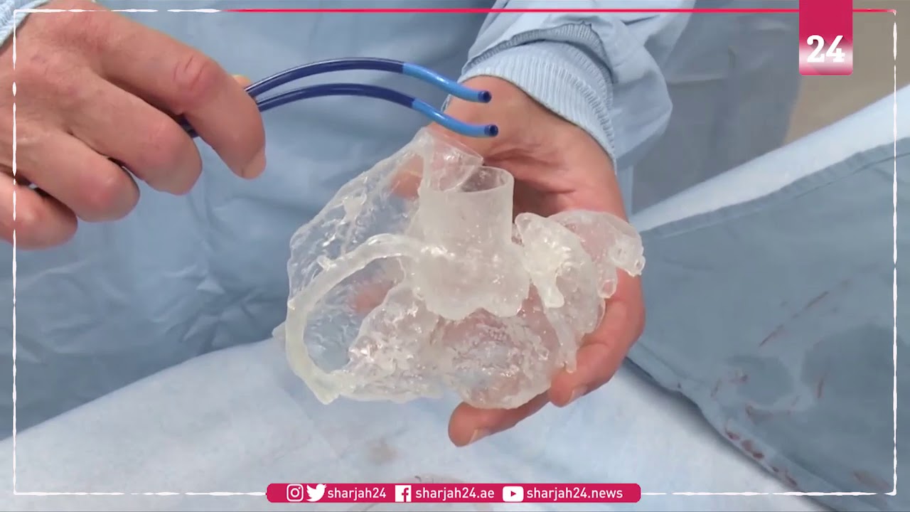 3D printed hearts allow surgeons to practice before an operation
