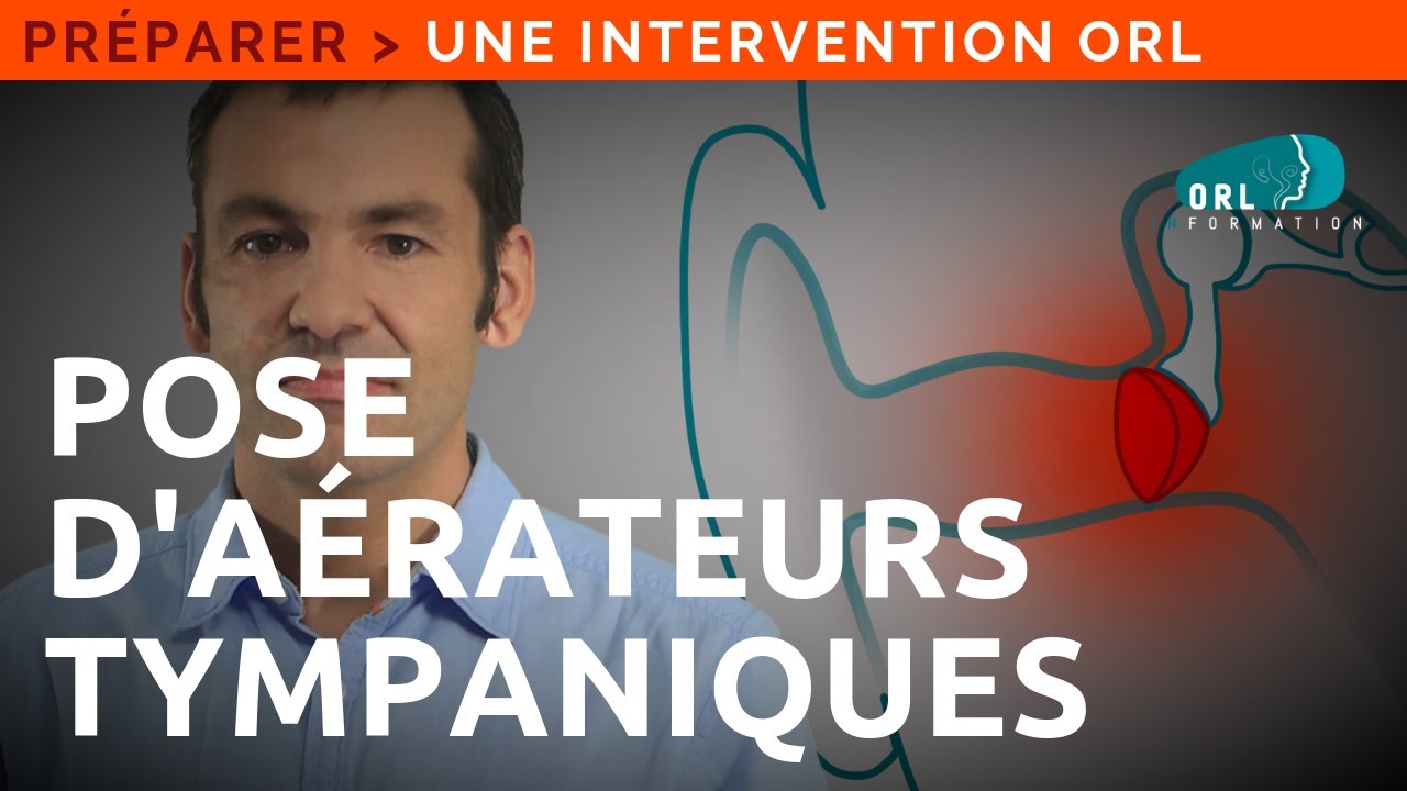 Information Patient | Pose d'aérateurs (diabolo) tympaniques
