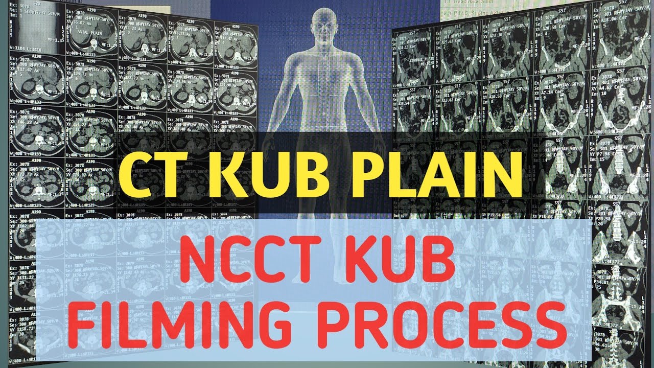 NCCT KUB FILMING PROCESS #CT KUB PLAIN FILMING PROCESS #CT KUB FILMING PROCESS