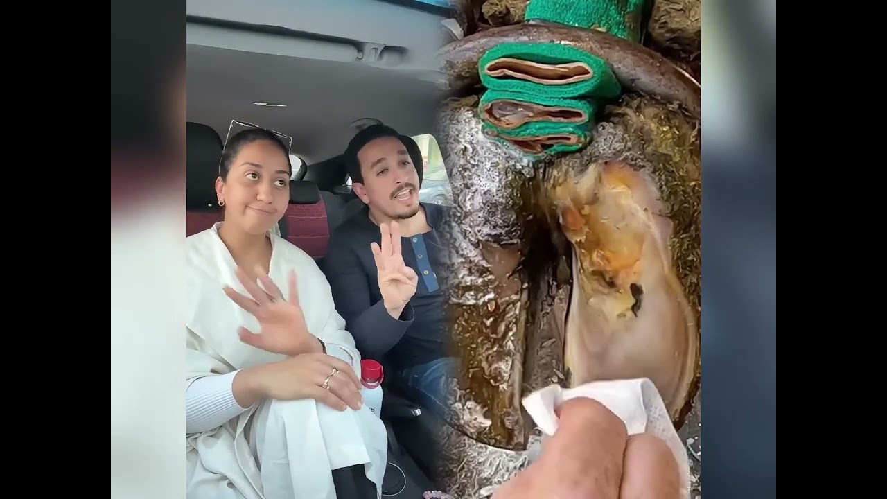 🤣👌👌👌2026 pov Must-Watch Crazy Clips Compilation #humor #fypシ #pov #fyp #foryou 😍😜