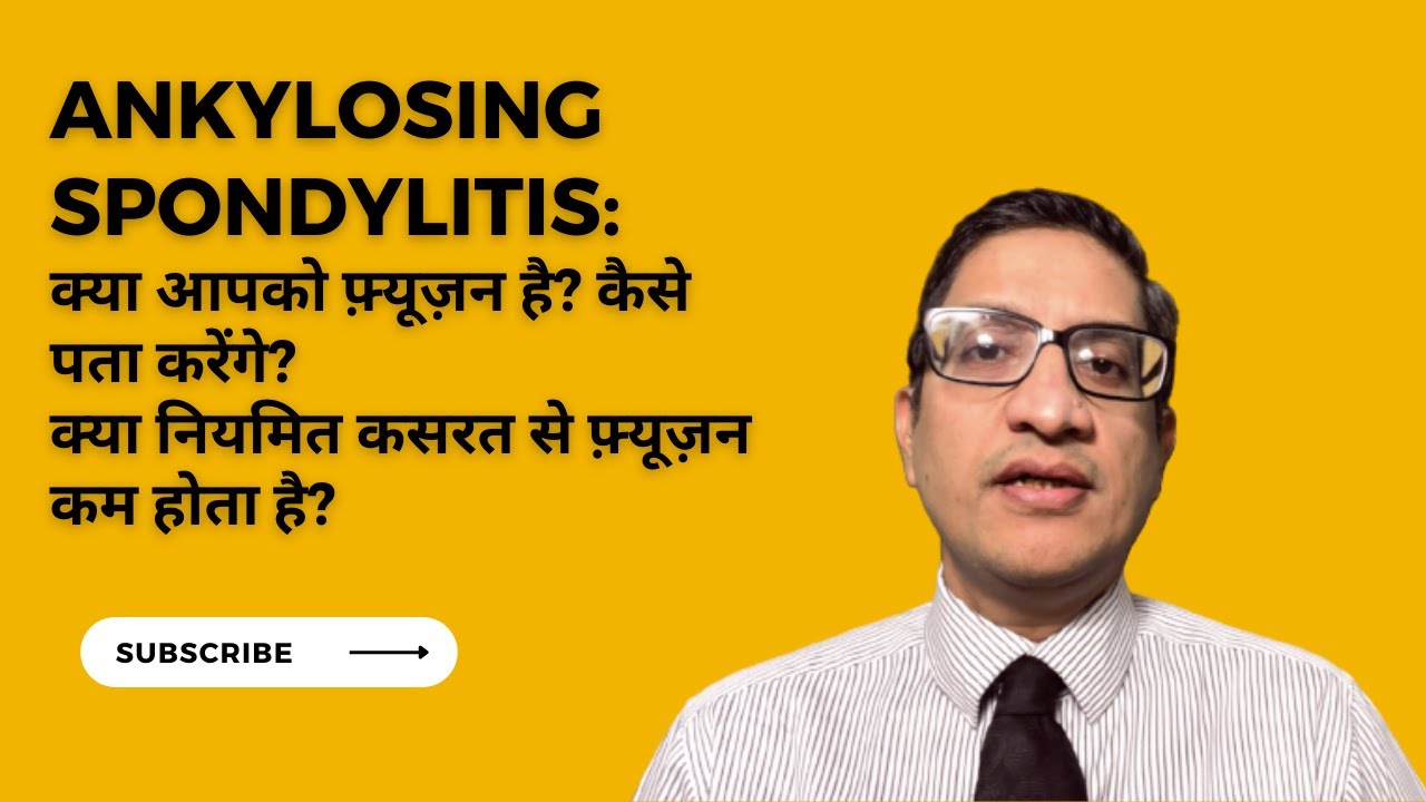 Ankylosing spondylitis:क्या आपको फ़्यूज़न है? कैसे पता करेंगे? क्या कसरत से फ़्यूज़न काम होता है?