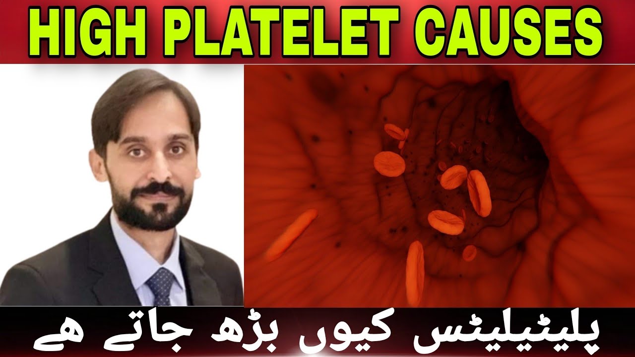 High Platelet Count | Causes of High Platelet in Blood
