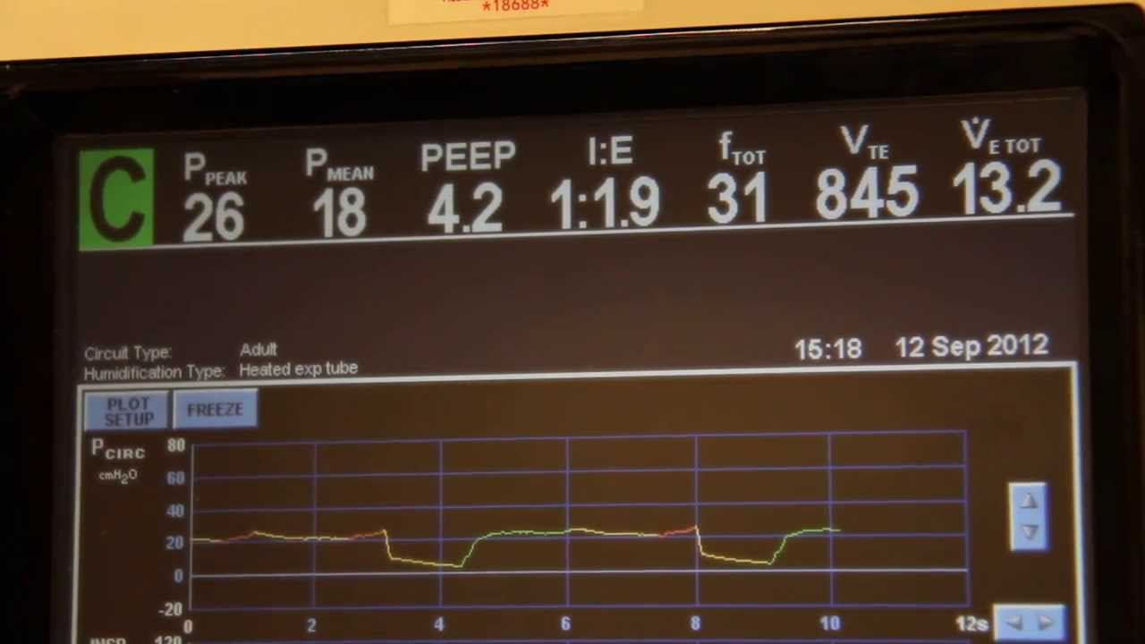 840- SETTING UP APRV